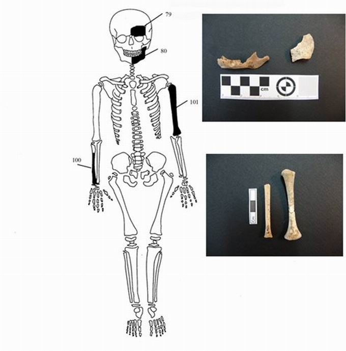amfipoli-nekroi-skeleti95